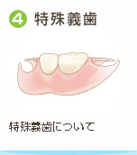 ④特殊義歯 / 特殊義歯について