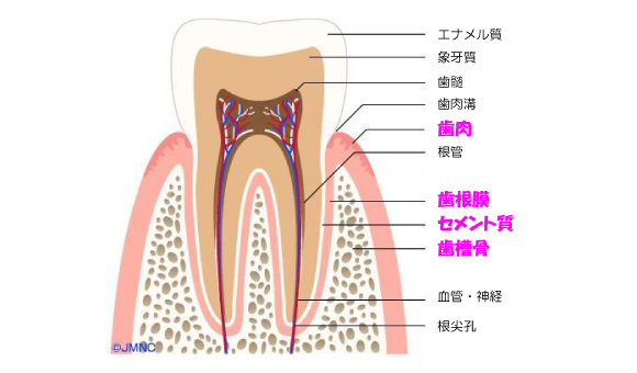 歯周病画像3