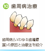 ⑩歯周病治療 / 歯周病(いわゆる歯槽膿漏)の原因と治療法を紹介