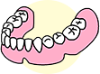 特殊義歯